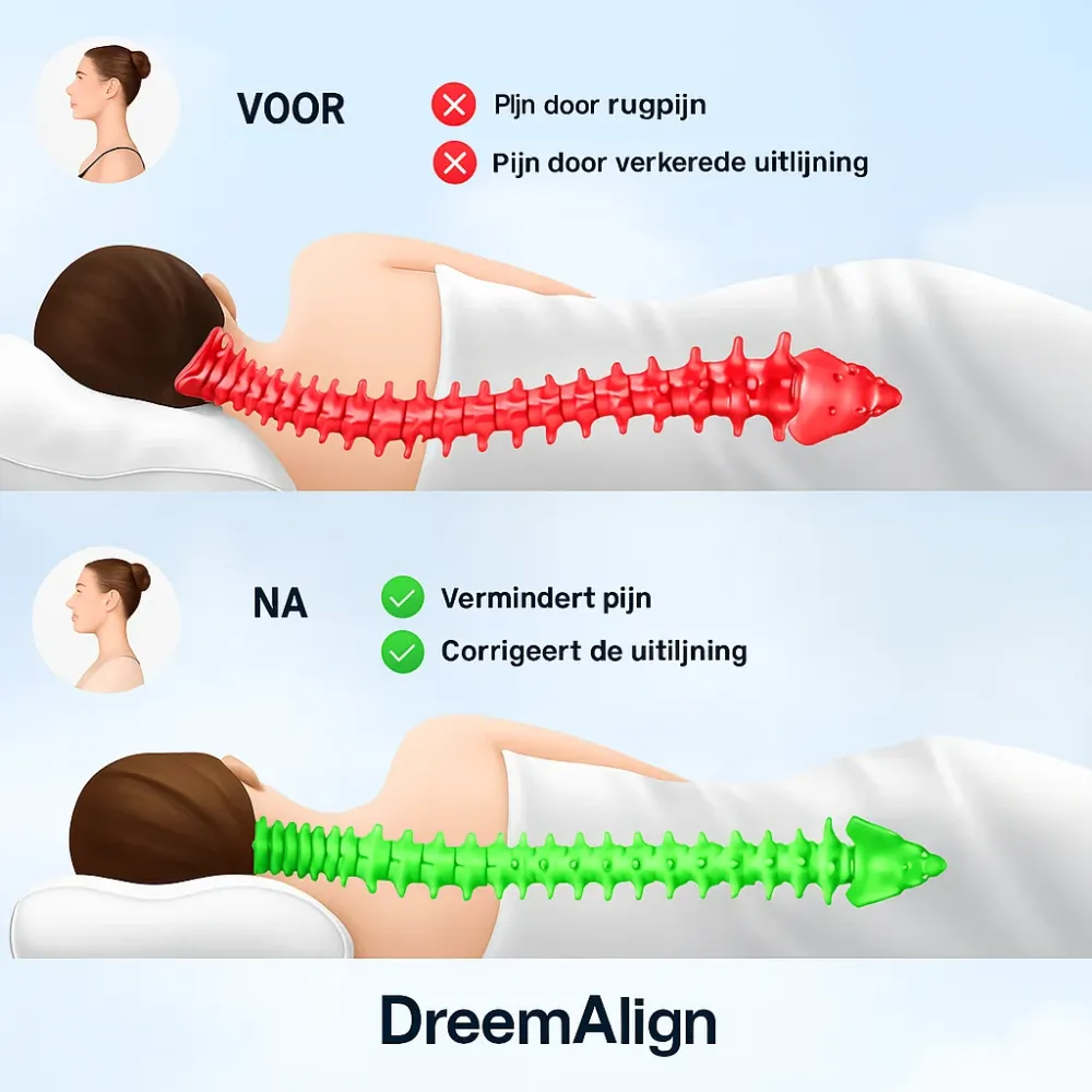 DreamAlign | Ergonomisch Kussen voor Pijnvrij en Rustgevend Slapen Finest Luxe