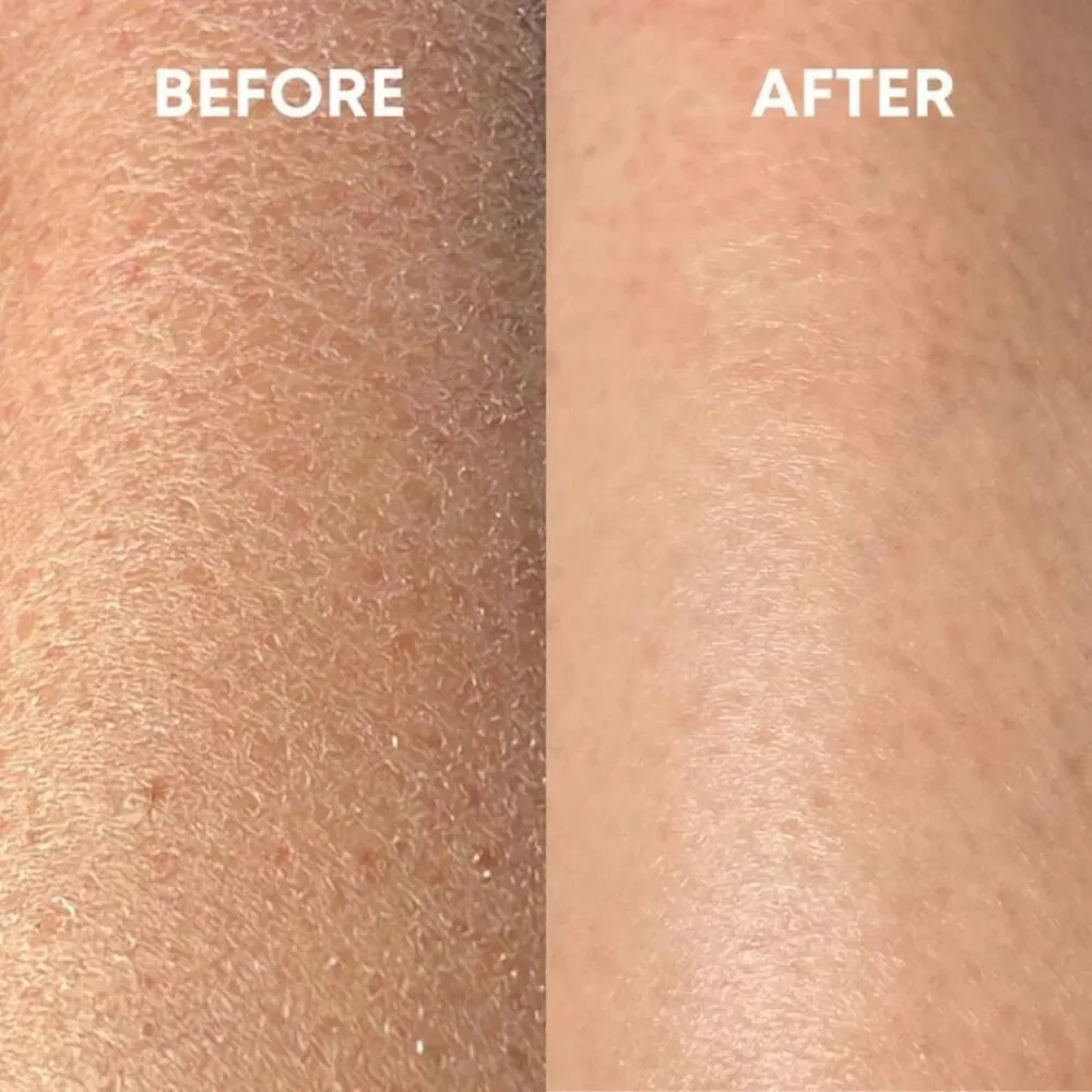 ExfoGlove | Natuurlijke Scrubhandschoen voor Zichtbaar Gladdere Huid Finest Luxe