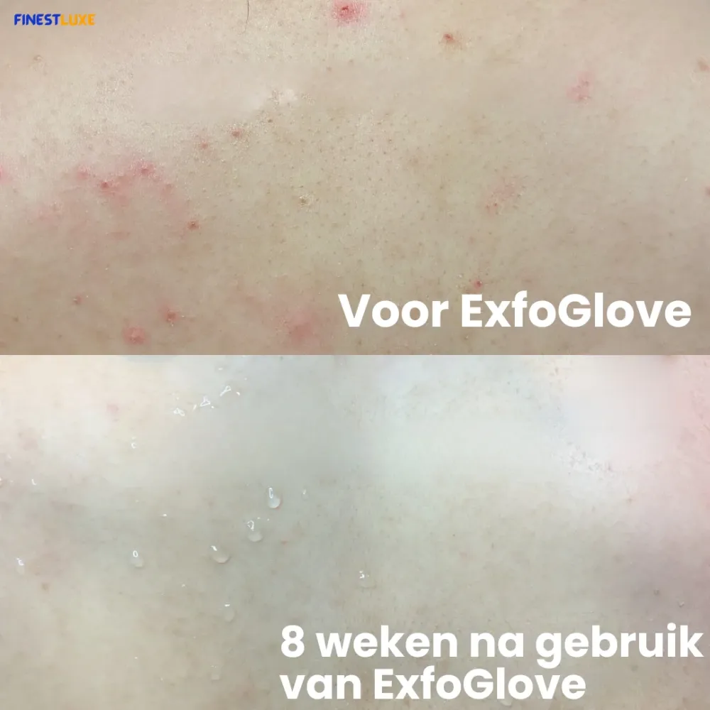 ExfoGlove | Natuurlijke Scrubhandschoen voor Zichtbaar Gladdere Huid Finest Luxe