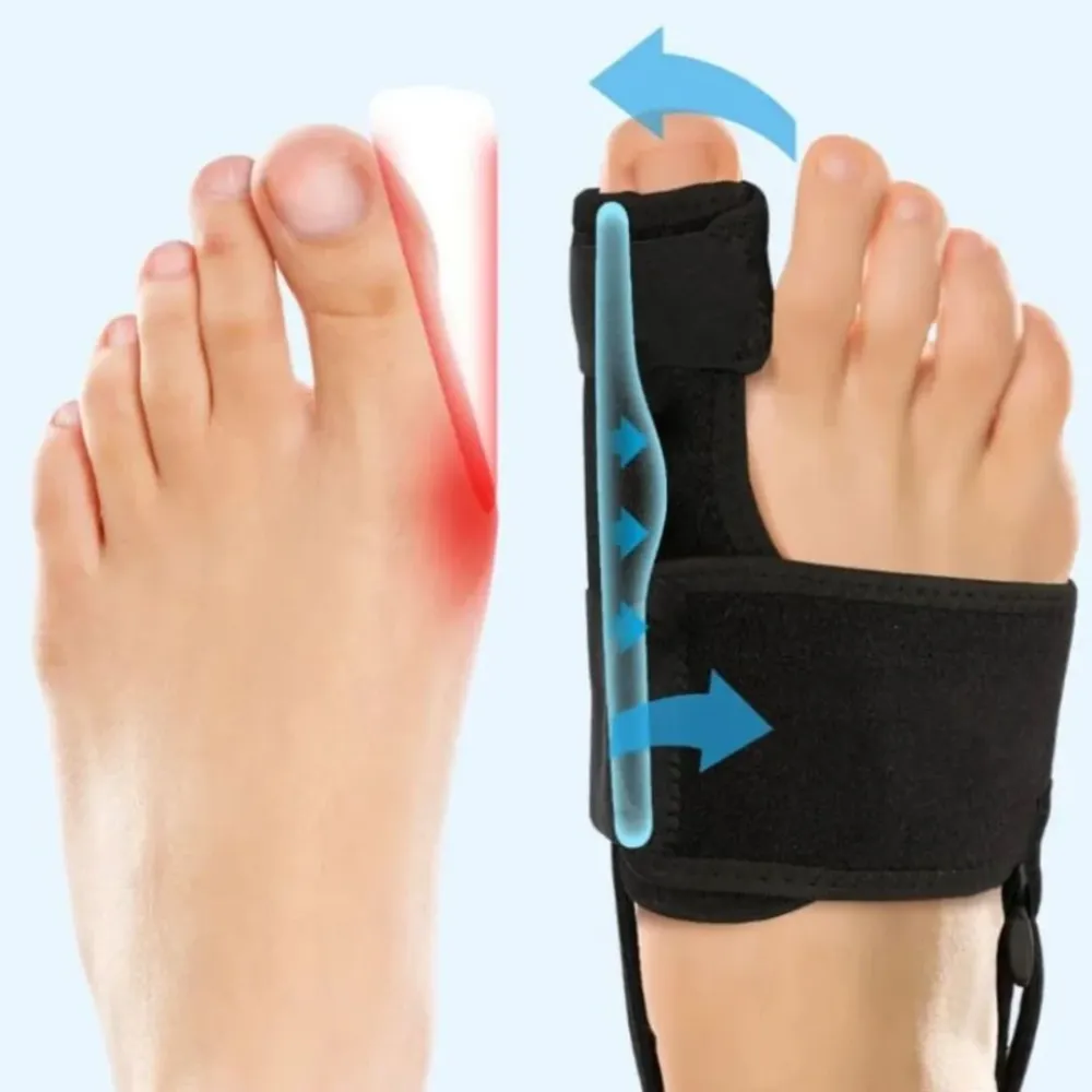 StepWell | Corrigerende Teenbrace voor Comfort & Mobiliteit Finest Luxe