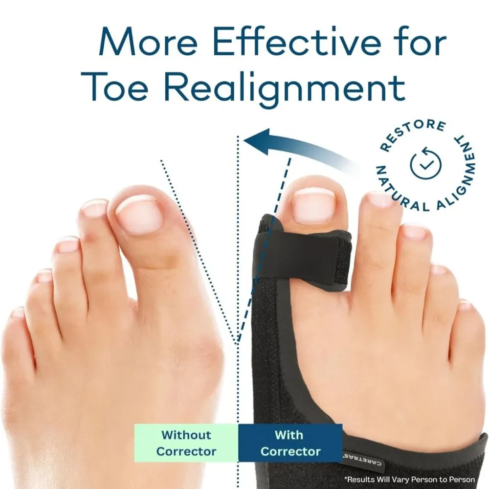 StepWell | Corrigerende Teenbrace voor Comfort & Mobiliteit Finest Luxe