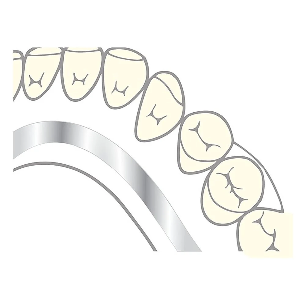 Steel lingual bar - resin reinforcement prosthesis - 10 pieces